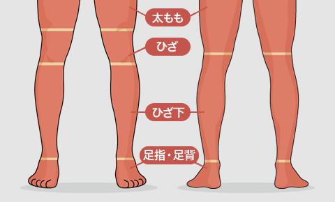 脚全体の照射範囲（ゴリラクリニック）