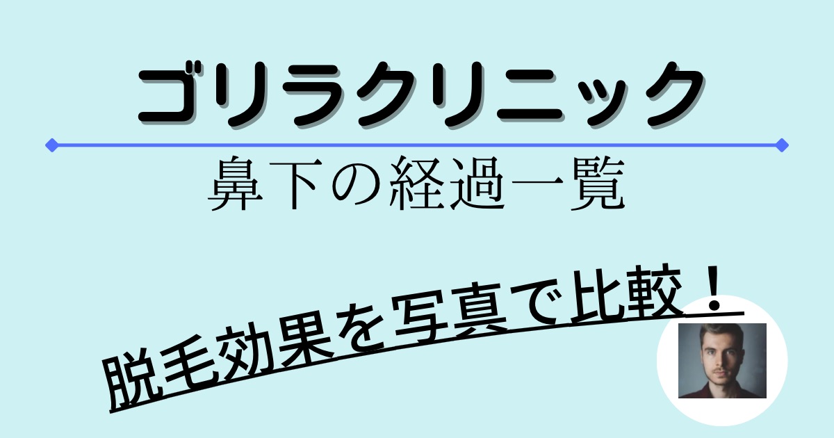 ゴリラクリニックの鼻下の経過一覧
