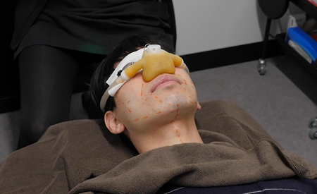 ゴリラクリニックの笑気麻酔