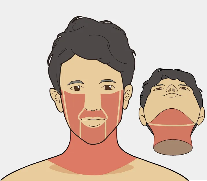 ゴリラクリニックの髭脱毛の照射範囲